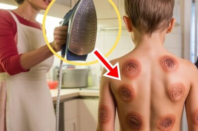 PADRE ENCUENTRA HIJO CON QUEMADURAS DE PLANCHA POR TODO EL CUERPO – MADRASTRA USABA COMO CASTIGO