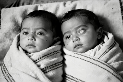 Lucía y Elena: Las Gemelas que Compartieron un Alma | Historia Real